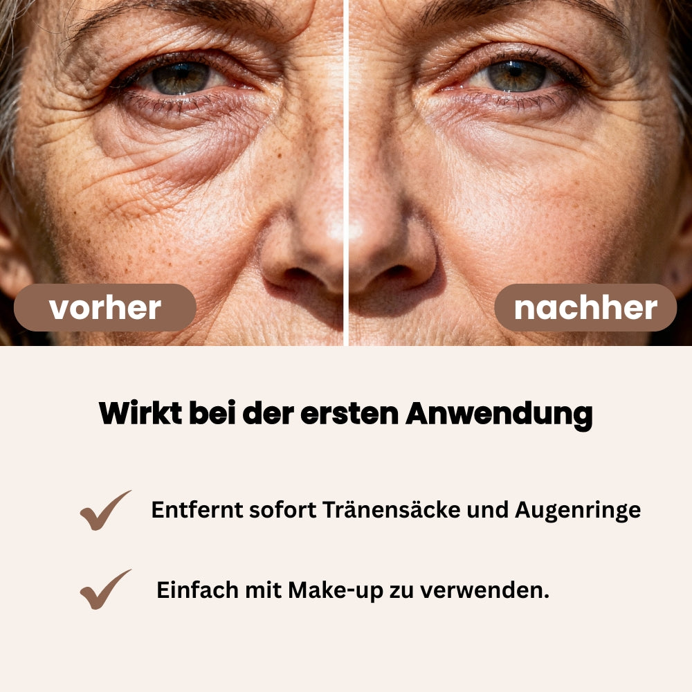 Luméa Augenstraffer